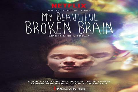 مشاهدة فيلم My Beautiful Broken Brain (2014) مترجم